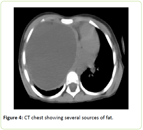 chronic-obstructive-pulmonary-disease-several-sources-fat